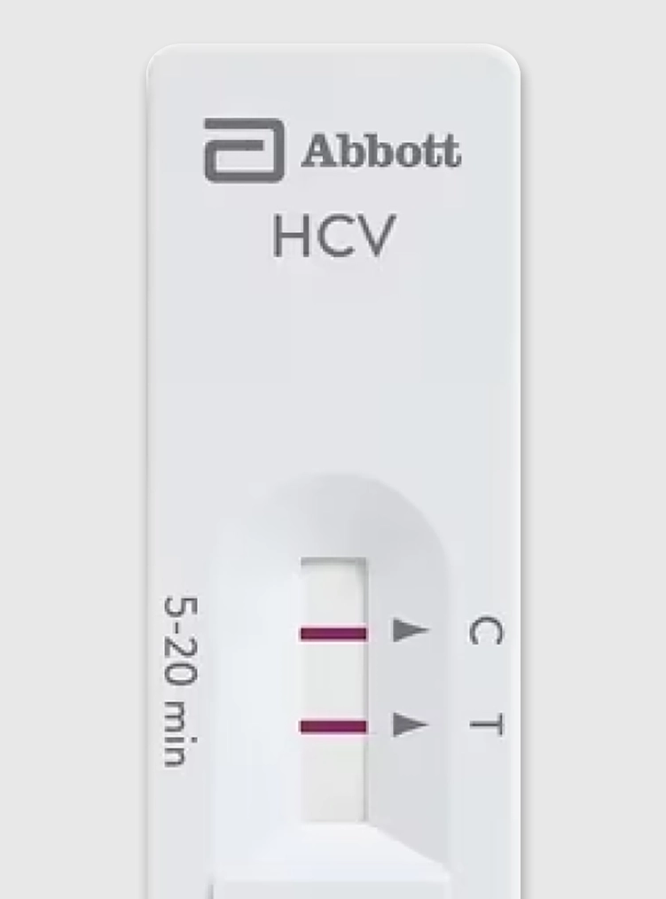 Test de Hepatitis C (HCV)